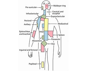 Lymphadenopathy LAD