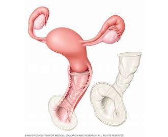Female Condom FEMIDOM