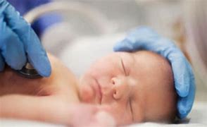 NICU