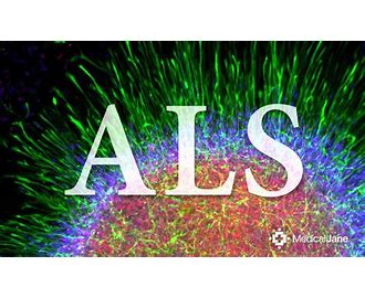 Amyotrophic Lateral Sclerosis ALS