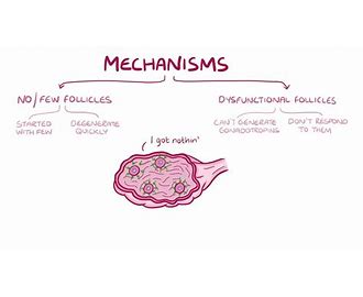 Premature Ovarian Failure POF