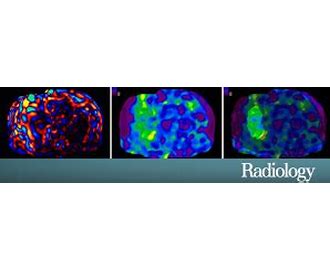 Radiological Society of North America RSNA