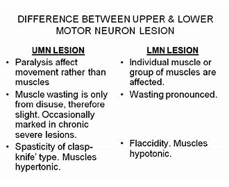 Upper Motor Neuron UMN