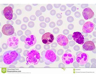 White Blood Cell WBC